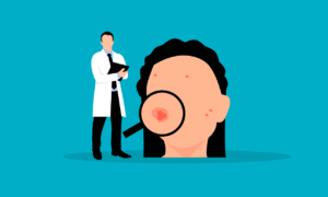 Acne: pro e contro dei trattamenti