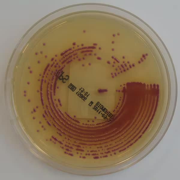 Colonie di batteri E. coli in una capsula di Petri. Nathan Reading/Flickr, CC BY-NC-ND

